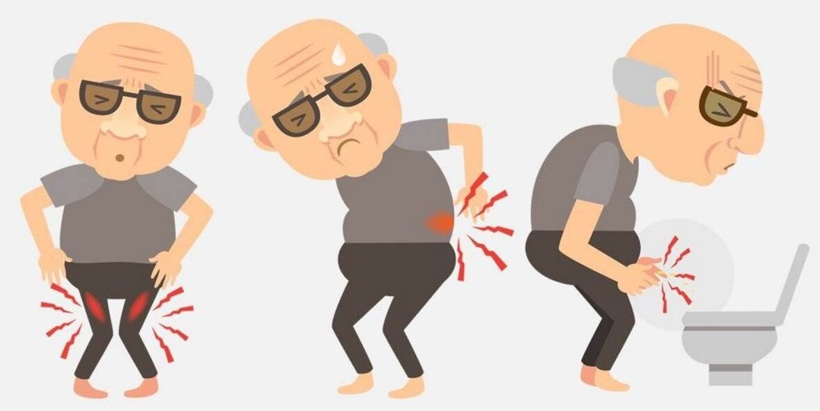 prostatīta simptomi